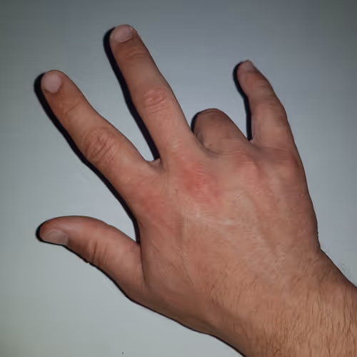 Myhands V2