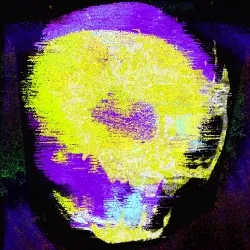 44