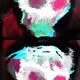 58
