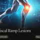 Meniscal Ramp Lesions