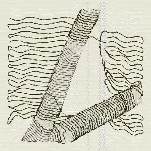 Aux Arbres