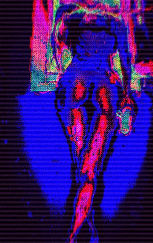 Item #4 Media