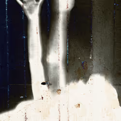 198