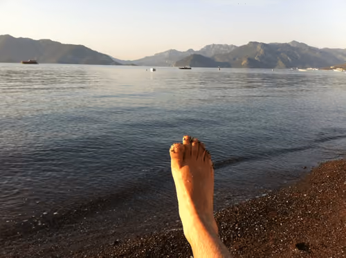 Foot #1