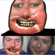 177