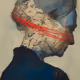 Scars