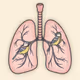 Lung tree