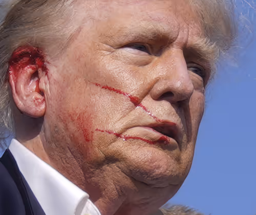 TRUMP EAR