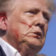 TRUMP EAR