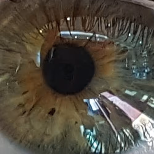 Sara Eye Revolution.