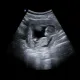 MARBI Ready to born