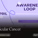 Testicular Cancer