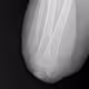 bone