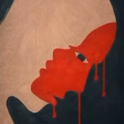 Artz