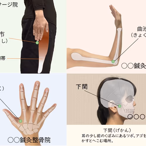 Acupuncture points