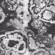 ALGAEX