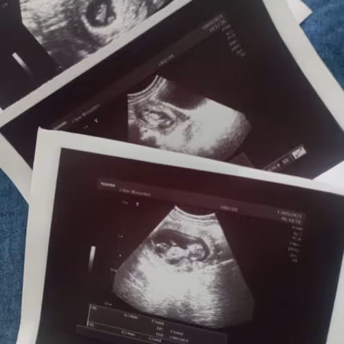 baby. - old