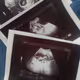 baby. - old