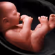 Baby In Womb