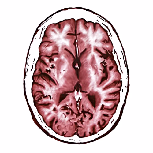 BrainDrop Organ13