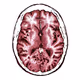 BrainDrop Organ13