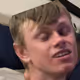 Bruised Brayans