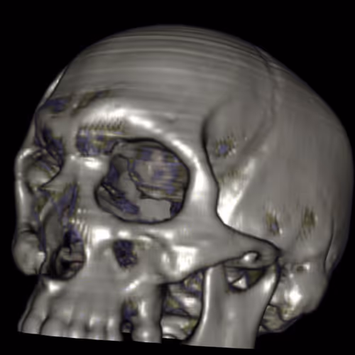 Project CT skull - old