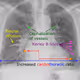 CXR