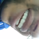 dental cases