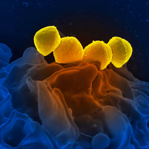 Electron microscopic art - Nature - old