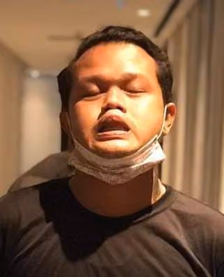 engodart
