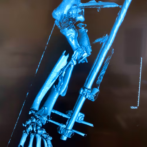 20 years of surgery around the world!