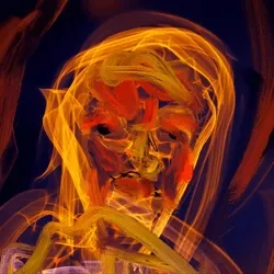 Item Media Placeholder