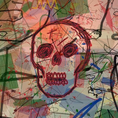 Fractures
