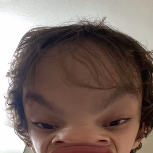 Toe Head