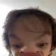 Toe Head