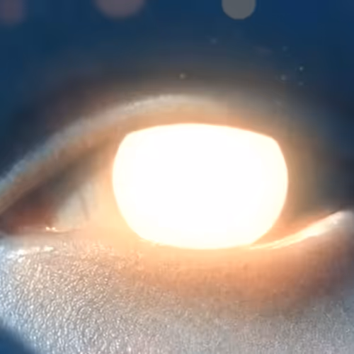 GoldenEyes