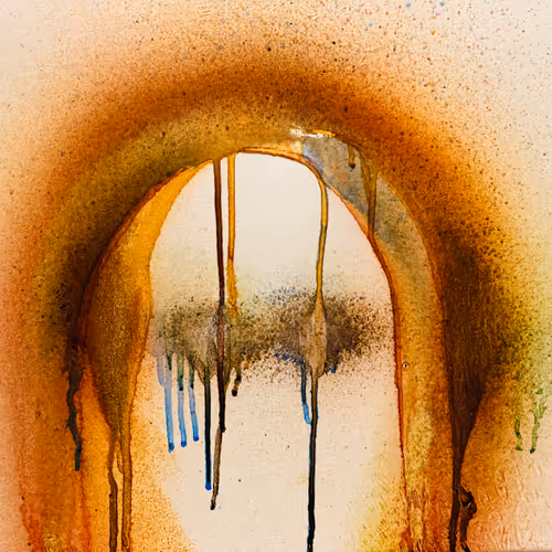 Hemorrhagic Stroke - FULL COMMERCIAL RIGHTS - old