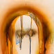 Hemorrhagic Stroke - FULL COMMERCIAL RIGHTS - old