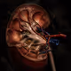 I S kidney