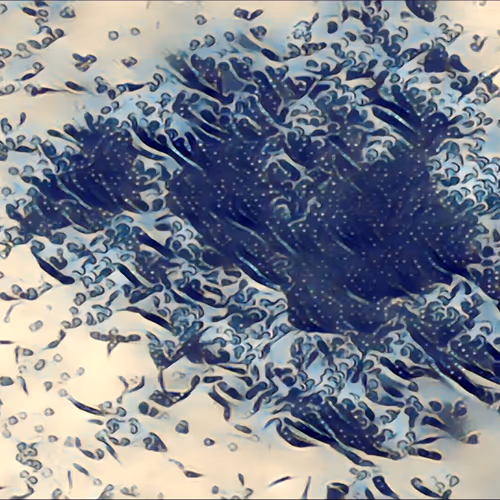 ImmunoNFT - old