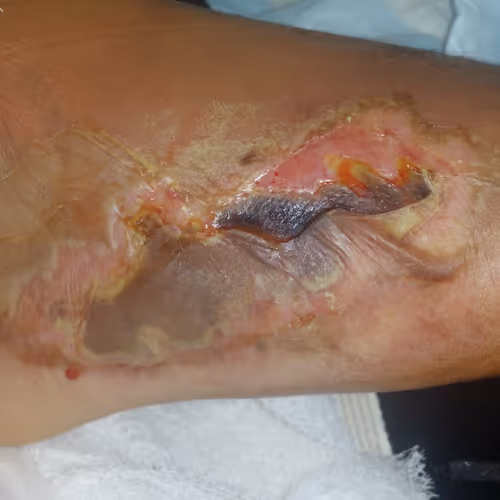 Injury Pictures - old