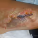 Injury Pictures - old