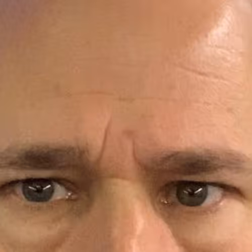 JON FOREHEAD