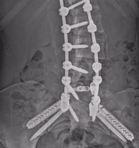 Surgical NFT's