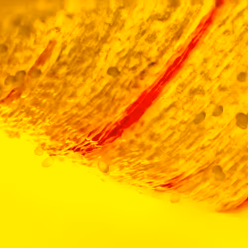 Microscopic yellow leaf
