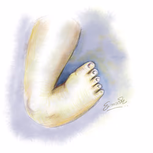 Childhood Disability