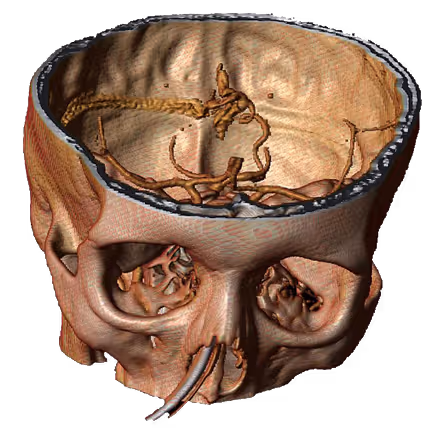 PHILIPS 2013 by Iain Ball