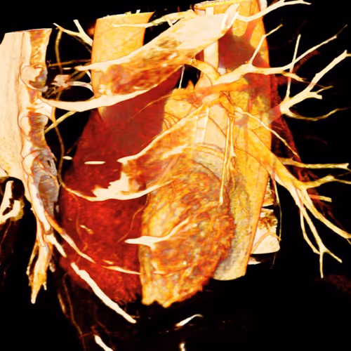 Project Schoma - old