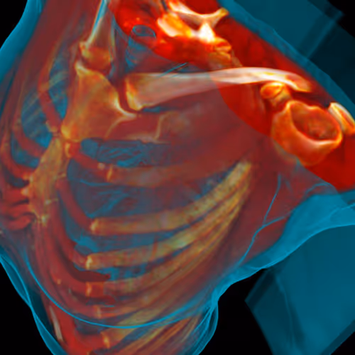 Project THORAX - old